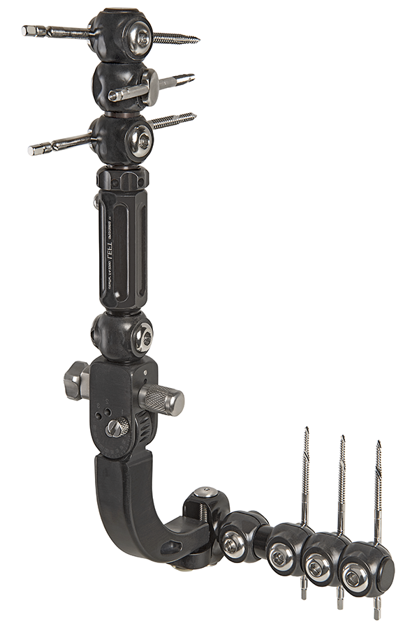 Elbow articulated external fixator Elbow articulated external fixator